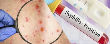 obat sipilis
